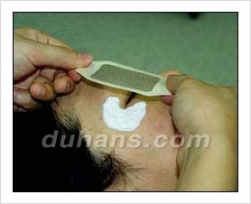 Duhan Plastic Surgery Wrinkle Improvement - Wrinkle Fillers, Juvederm image 6