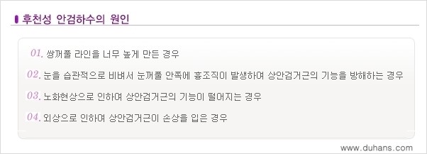 [두한성형외과 경쟁력 눈성형] - [안검하수(졸린 눈매) 재수술 안내 ①] 관련 이미지 10