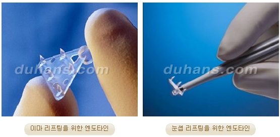 두한성형외과 안티에이징 리프팅 - 엔도타인 리프팅 관련 이미지 4