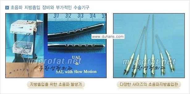 [두한성형외과 경쟁력 지방흡입] - [얼굴, 볼살, 턱살, 턱선의 초음파 지방흡입] 관련 이미지 6