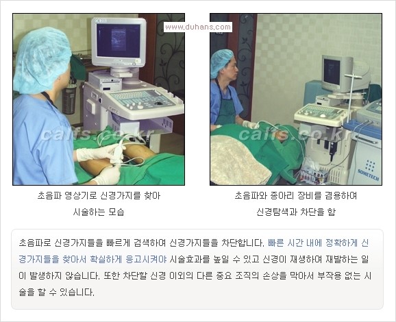 [두한성형외과 경쟁력 멀티종아리성형] -  [종아리 축소술의 여러 가지 종류] 관련 이미지 16