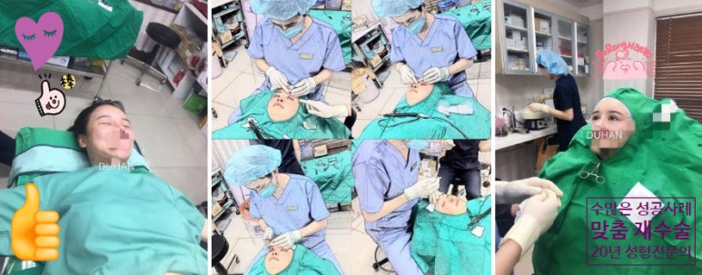 두한성형외과 눈재수술 - 쌍꺼풀 재수술 방법 관련 이미지 72
