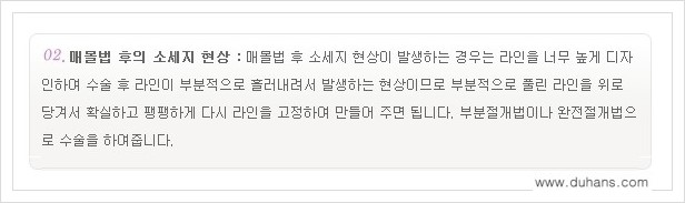 [두한성형외과 경쟁력 쌍꺼풀 재수술(극한 재수술)] - [절개선 아래가 두툼한 소세지 현상 안내] 관련 이미지 3
