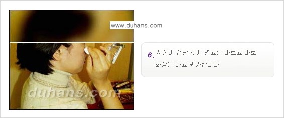 [두한성형외과 함몰 흉터 교정] - [동시에 3가지 시술로 효과적인 흉터의 교정 안내 ①] 관련 이미지 10