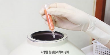 [두한성형외과 다크서클] - [다크서클 콜펫지방이식] 관련 이미지 9