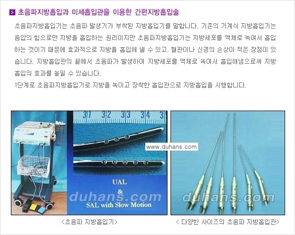 [두한성형외과 성형 FOCUS 간편 지방흡입] - [비만 탈출! 초음파 지방흡입 ①] 관련 이미지 4