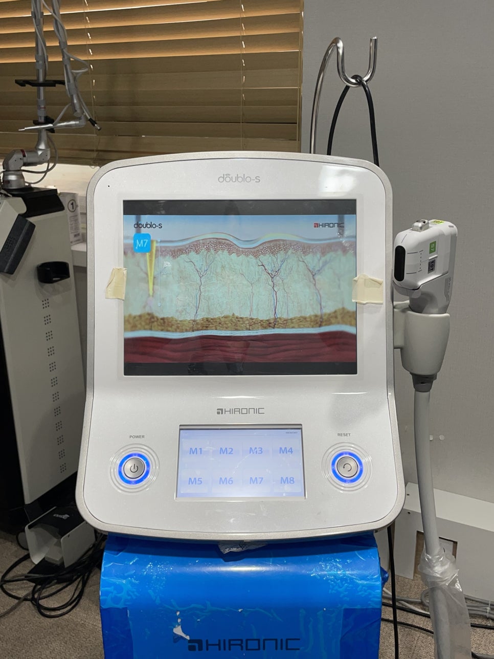 짝눈교정 나에게 맞는 방법으로 관련 이미지 6