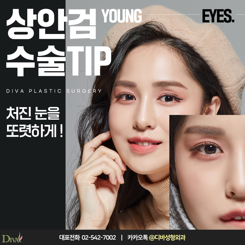[디바성형외과] 늘 선명한 눈매를 위해, 눈꺼풀처짐수술! 관련 이미지 4