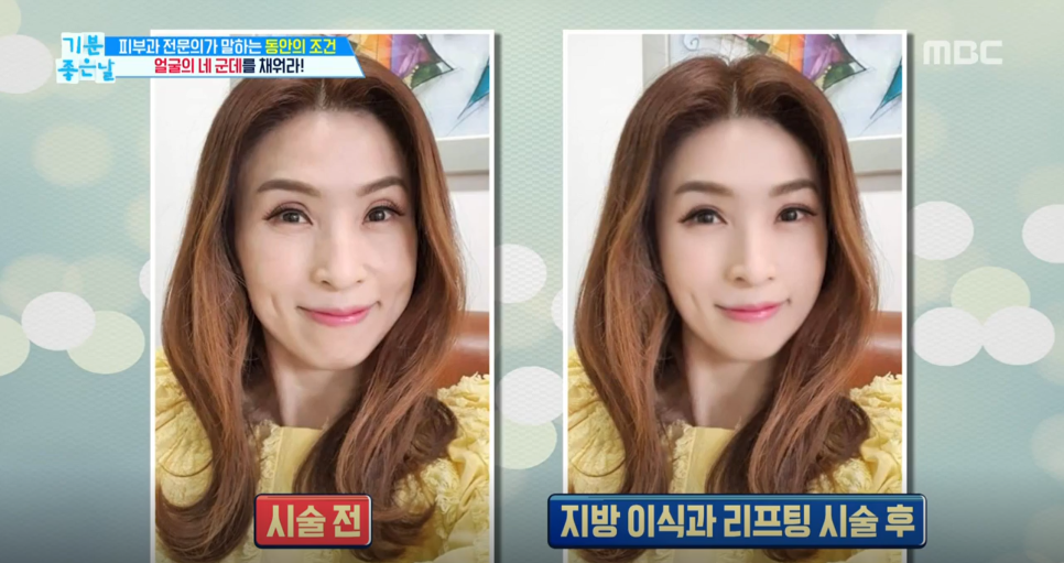 가상성형 후 더 예뻐진 연예인은? 관련 이미지 7