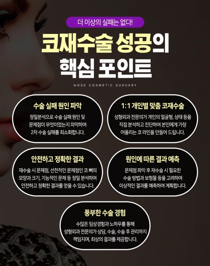 코재수술잘하는곳 찾는 이유는? 관련 이미지 5