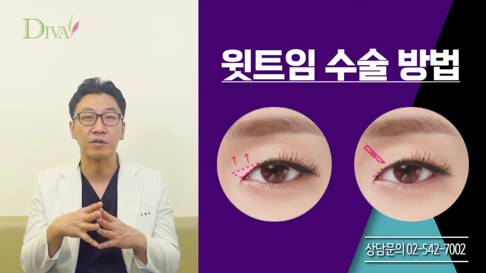 뒷트임 고민된다면 관련 이미지 3