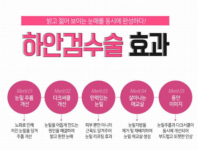 눈밑하안검수술 동안으로 가는 지름길! 관련 이미지 6