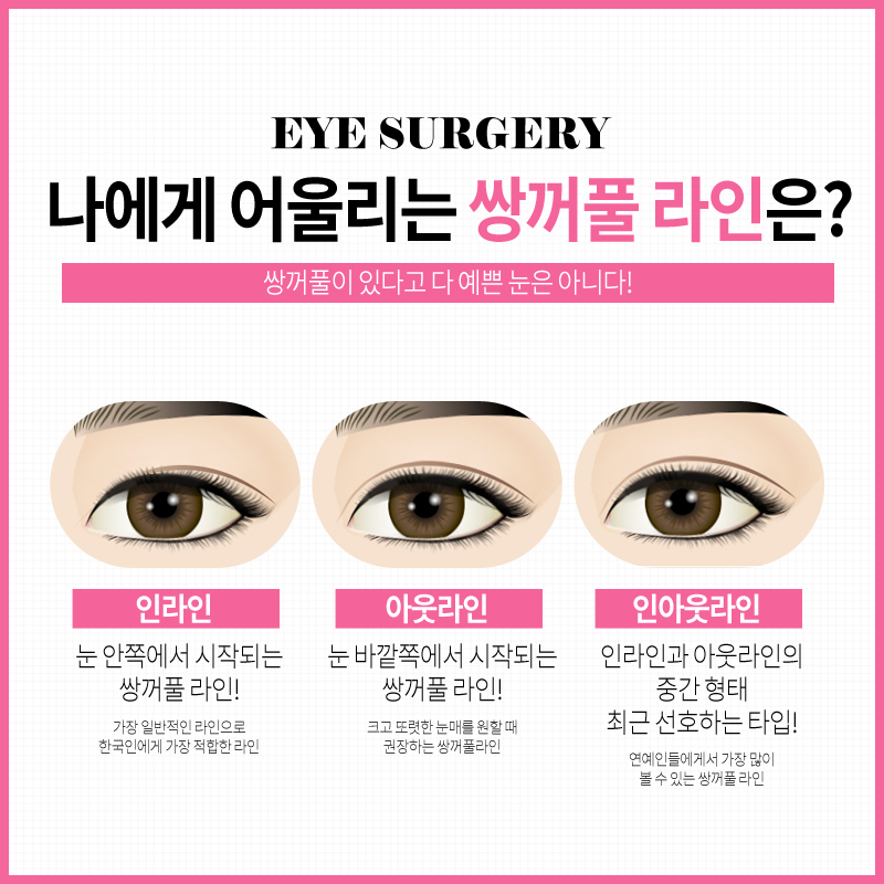 쌍꺼풀수술? 트임수술? 나에게 맞는 눈성형은? 관련 이미지 6
