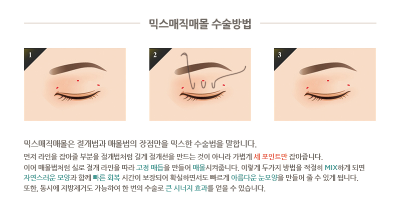 디바성형외과 7,8월 이벤트 안내 관련 이미지 4