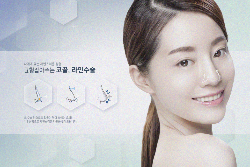 콧볼축소수술 전 주의사항부터 하나씩 관련 이미지 10