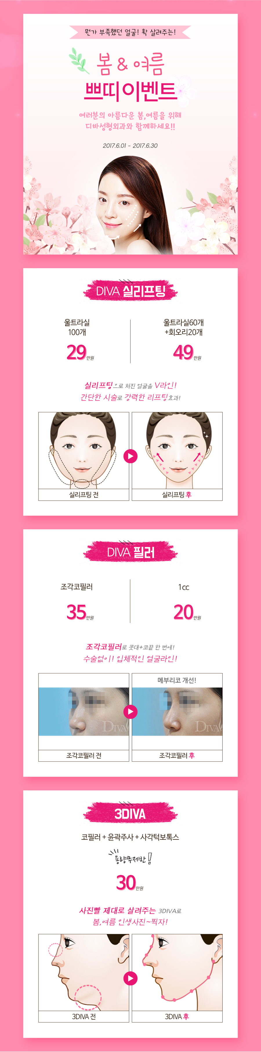 디바성형외과 여름 쁘띠이벤트 안내 관련 이미지 2