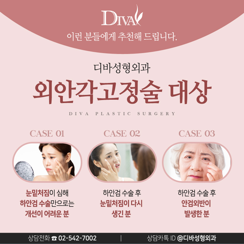 [디바성형외과] 중년눈성형을 통해 눈밑주름 사라져! 관련 이미지 4