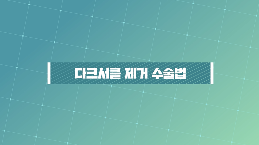 디바성형외과 김종명 원장 Q&A 영상! 관련 이미지 7