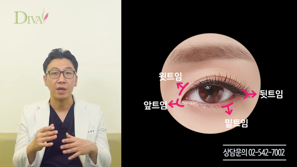 눈매교정술 개개인에 따라 관련 이미지 5