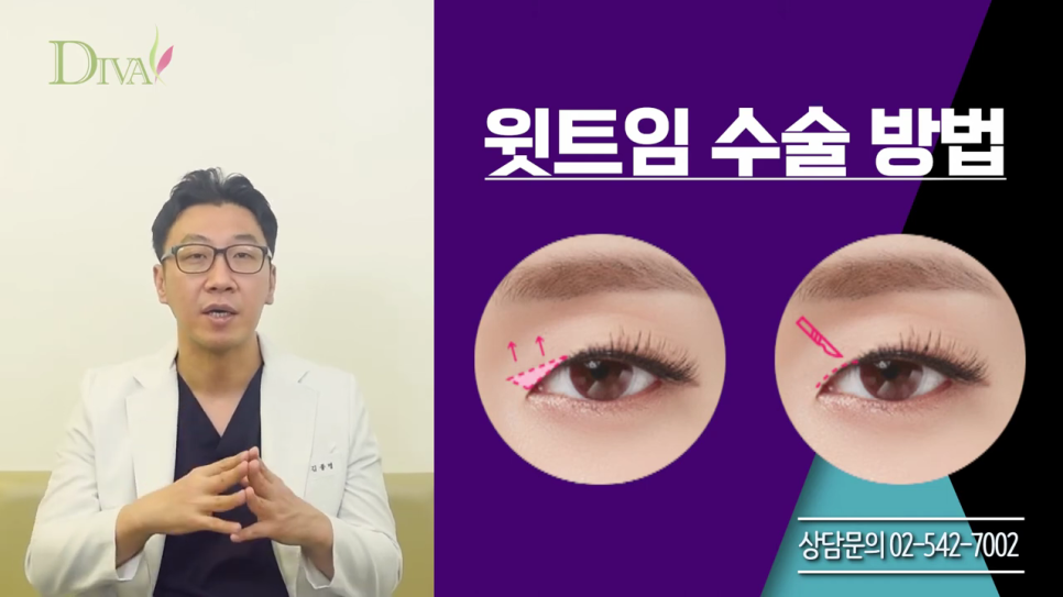 눈매교정술 개개인에 따라 관련 이미지 4