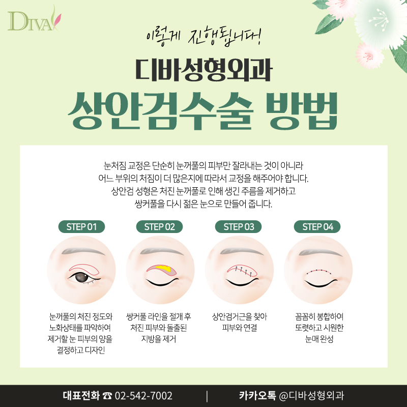 중년눈성형, 처진 눈꺼풀을 확실하게 UP! 관련 이미지 4