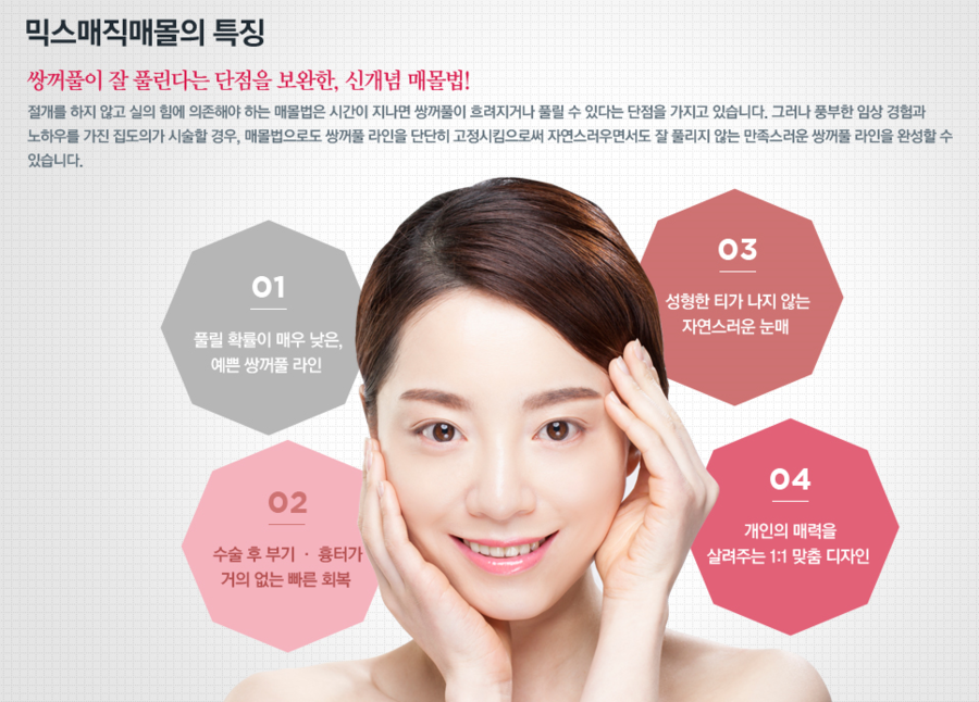 디바성형외과의 눈성형, 믹스매직매몰이란? 관련 이미지 5