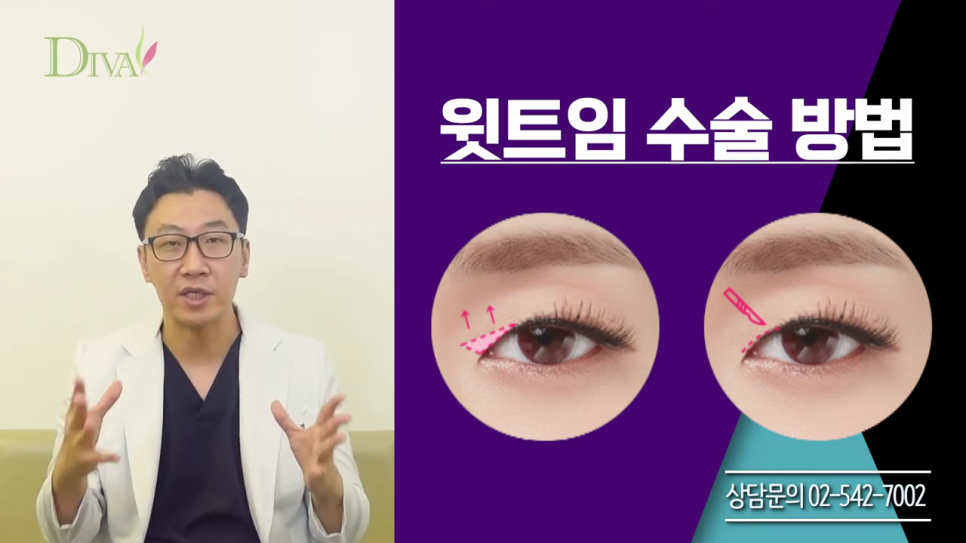 중년눈매교정 또렷함을 바란다면 관련 이미지 4