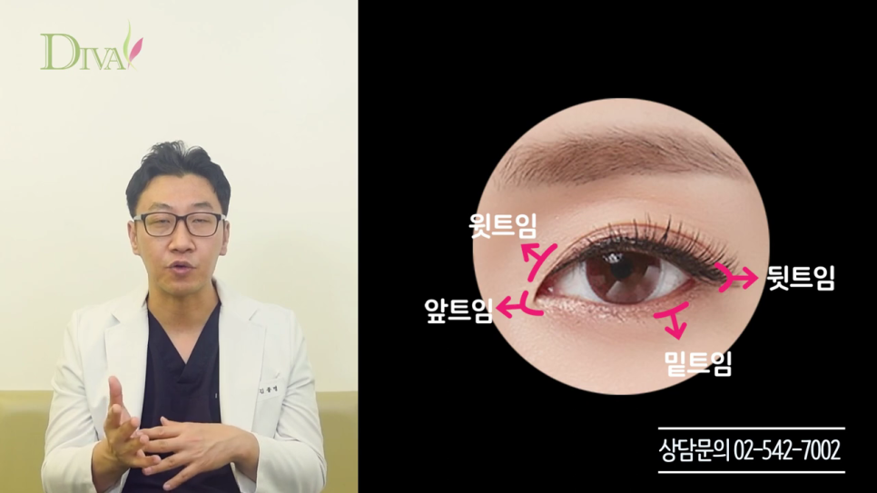 중년눈매교정 필요한 이유는 관련 이미지 6