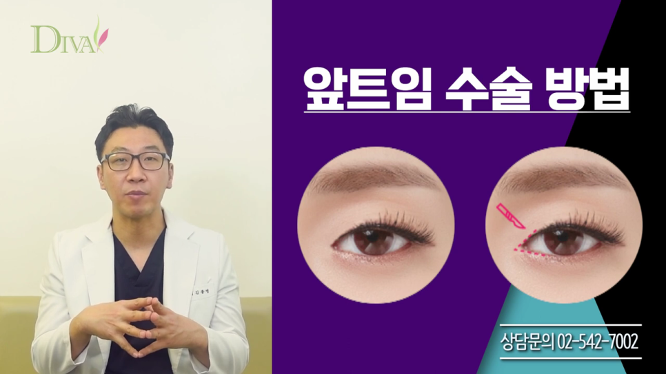 중년눈매교정 필요한 이유는 관련 이미지 2