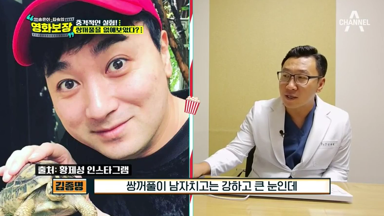 디바성형외과 &ldquo;송은이 김숙의 영화보장&rdquo;프로그램에서 김종명 원장님이 소개한 가상성형 전후 사진은? 관련 이미지 11