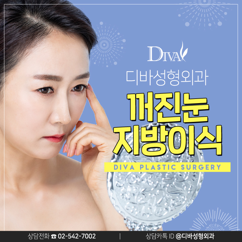 눈두덩이지방이식 눈두덩이꺼짐이 고민이시라면! 관련 이미지 1