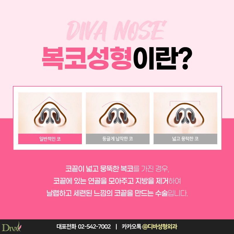 [디바성형외과] 복코성형으로 세련미 넘치게 관련 이미지 2