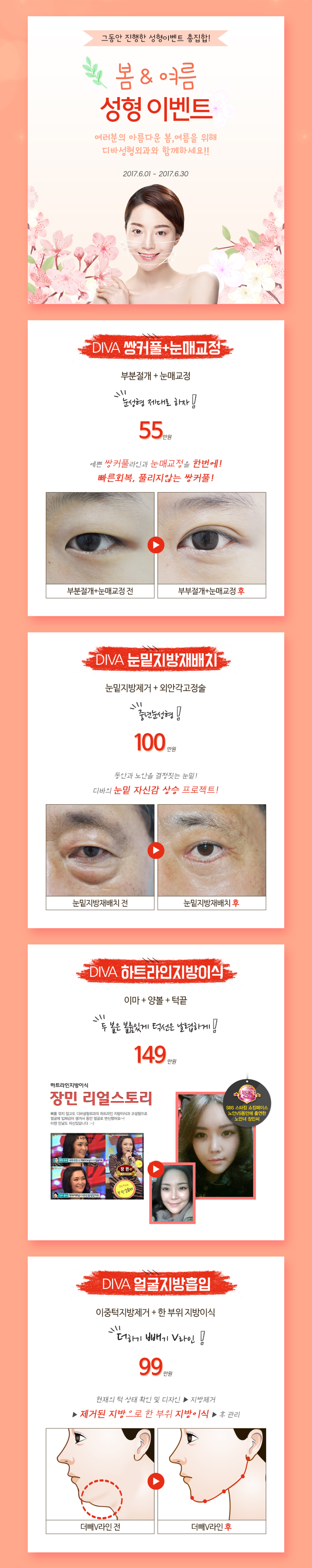 디바성형외과 여름 성형이벤트 안내 관련 이미지 2