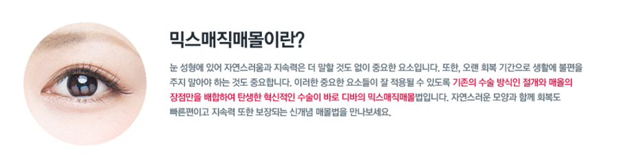 디바성형외과의 눈성형, 믹스매직매몰이란? 관련 이미지 2