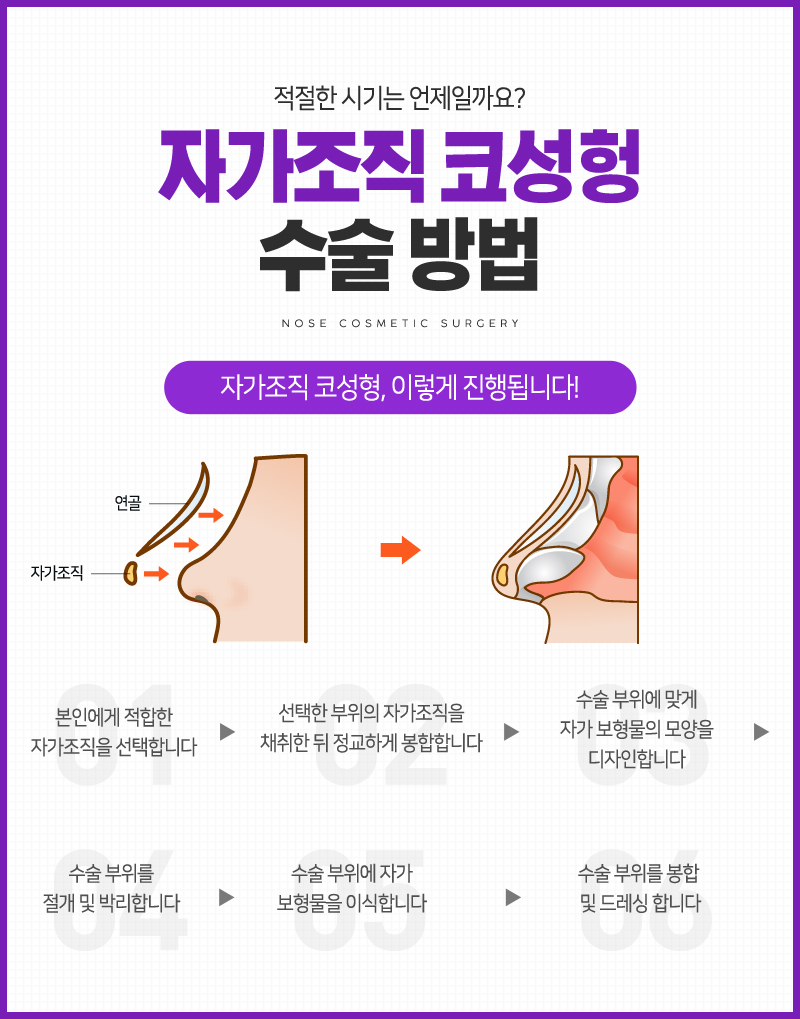 나에게 필요한 코성형 수술 방법 관련 이미지 5