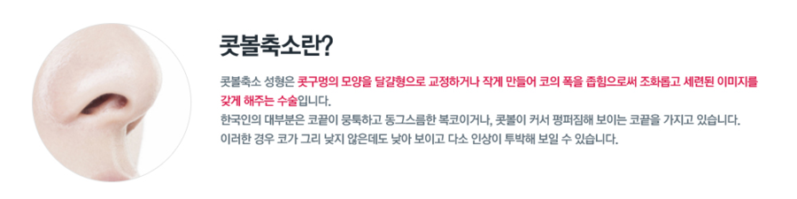 복코수술 세련된 라인으로 완성! 관련 이미지 3