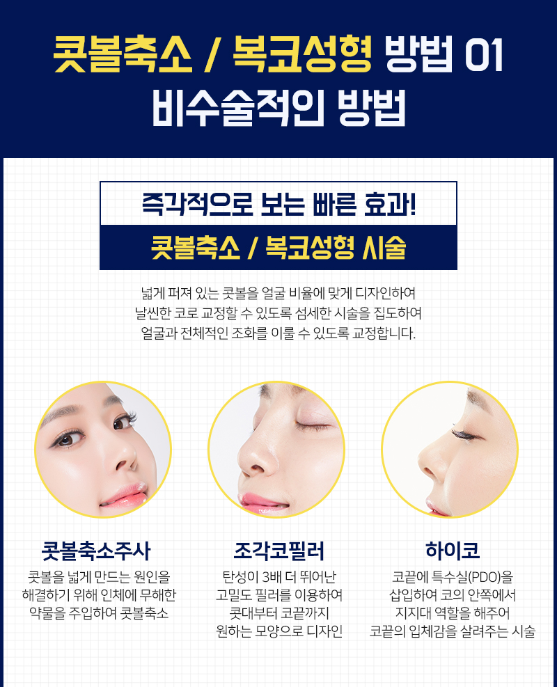 코성형 능력자가 말하는 복코 & 콧볼축소 방법은? 관련 이미지 7