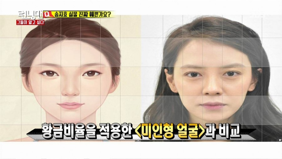 SBS 런닝맨에 출연하신 디바성형외과 김종명원장님! 관련 이미지 2