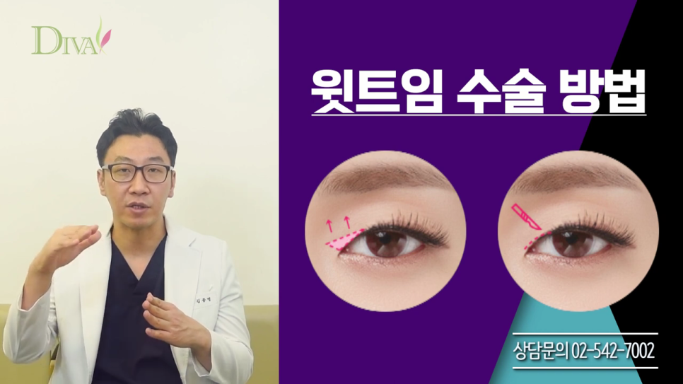 중년눈매교정 필요한 이유는 관련 이미지 3