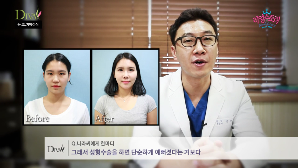 안검하수눈매교정 눈 처짐을 개선하면 관련 이미지 4