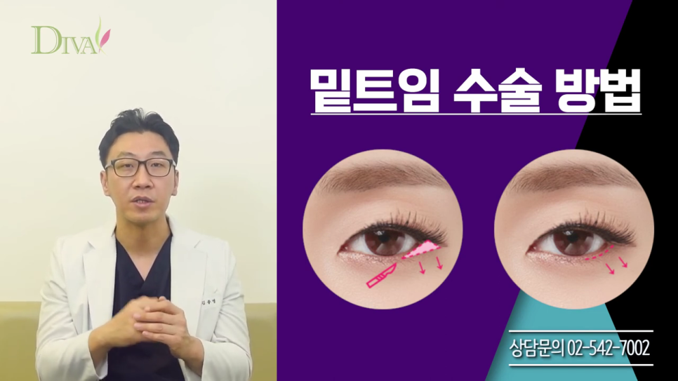 중년눈매교정 또렷함을 바란다면 관련 이미지 6