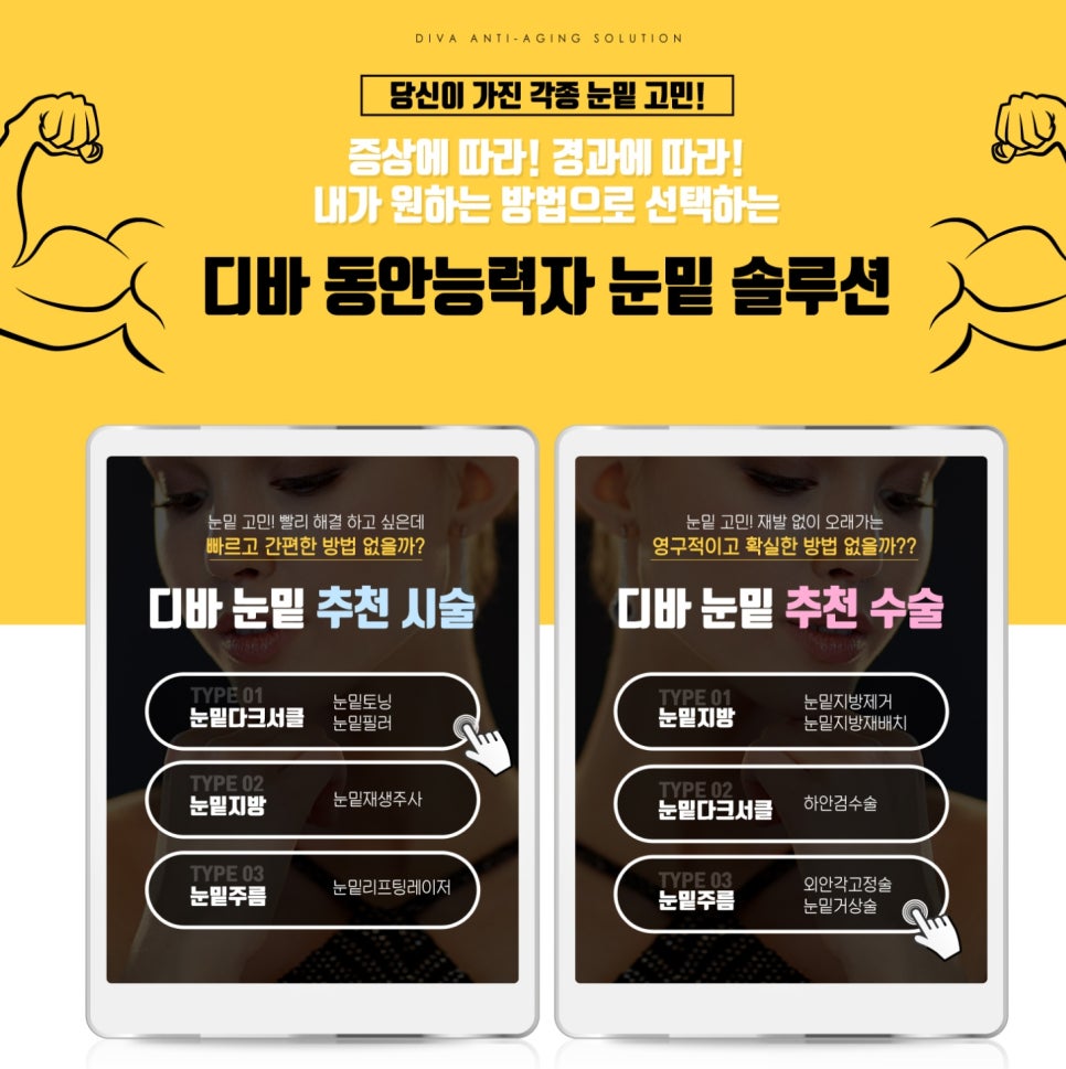 디바성형외과 눈밑 동안능력자 스페셜페이지 오픈! 관련 이미지 2