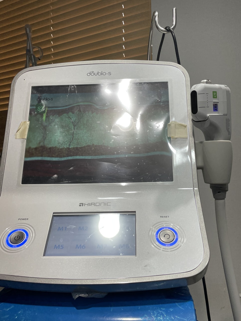 코재수술이 필요한 유형에 대해 알아봐요 관련 이미지 6