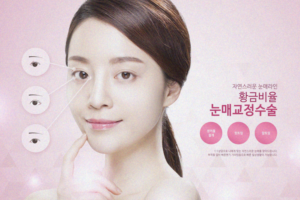 눈밑지방재배치수술 필요한 사람은 관련 이미지 9