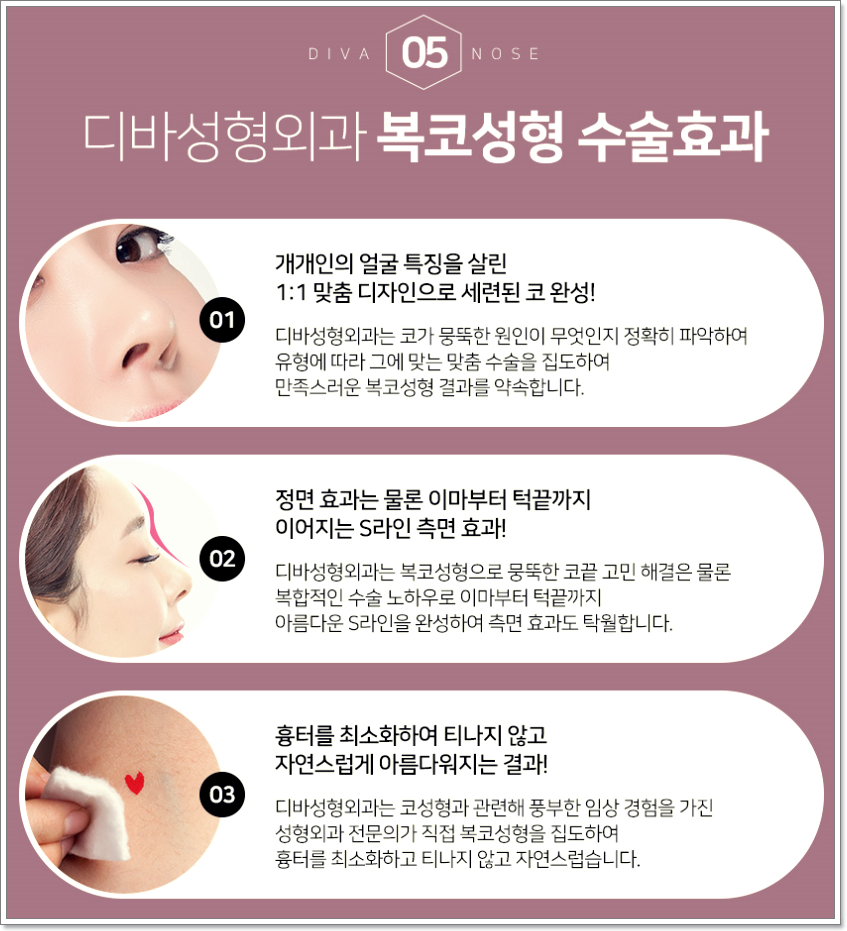 복코성형외과 진짜가 나타났다! 관련 이미지 7