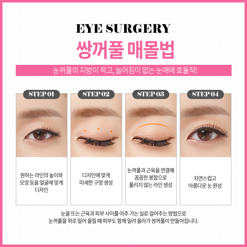 쌍꺼풀수술? 트임수술? 나에게 맞는 눈성형은? 관련 이미지 7