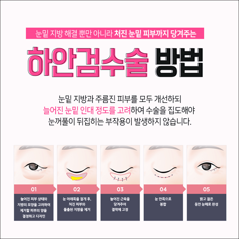 김종국친형 알고보니! 더 놀랍다! 관련 이미지 6