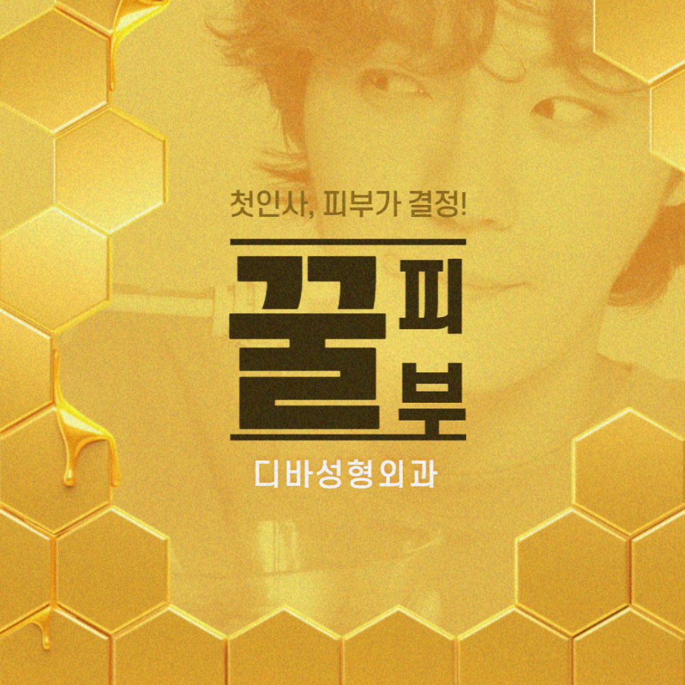 눈밑지방제거 다크서클 없는 동안으로! 관련 이미지 10