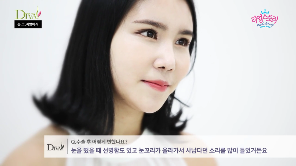 안검하수눈매교정 눈 처짐을 개선하면 관련 이미지 5