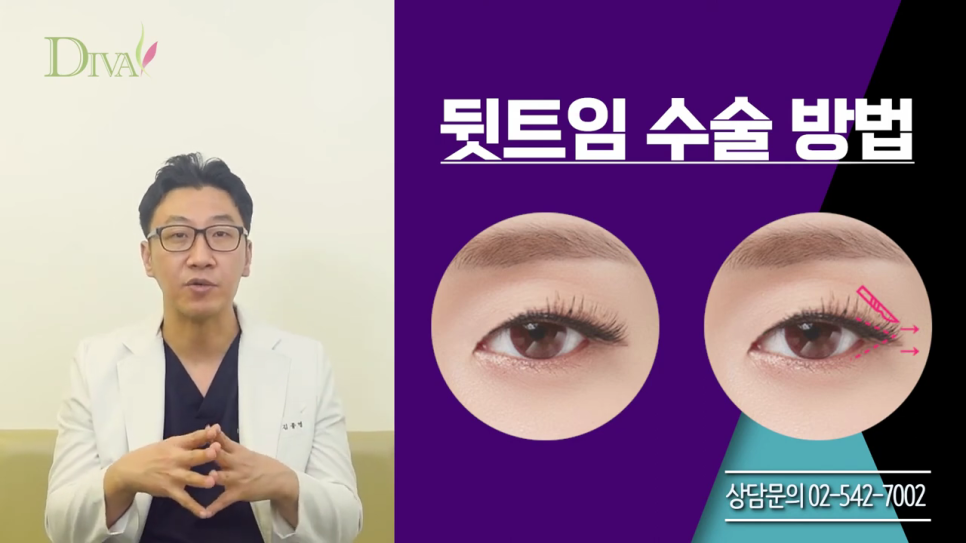 중년눈매교정 또렷함을 바란다면 관련 이미지 5